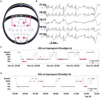 Case report: Nocturnal low-frequency stimulation of the centromedian thalamic nucleus improves sleep quality and seizure control